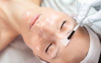 Finger Lakes Dermatology: Your Guide to Chemical Peels