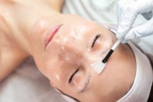 Finger Lakes Dermatology: Your Guide to Chemical Peels